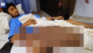 Najveći tumor ikada: Težak je 35 kilograma, lekari ostali šokirani njegovom veličinom (NECENZURISANE FOTOGRAFIJE)